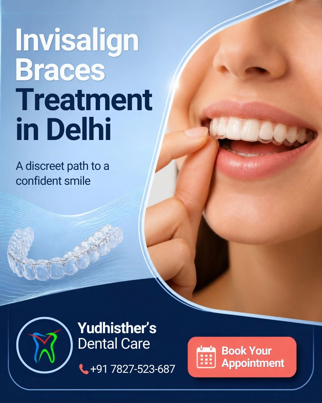 Best Invisalign Braces Treatment in Delhi