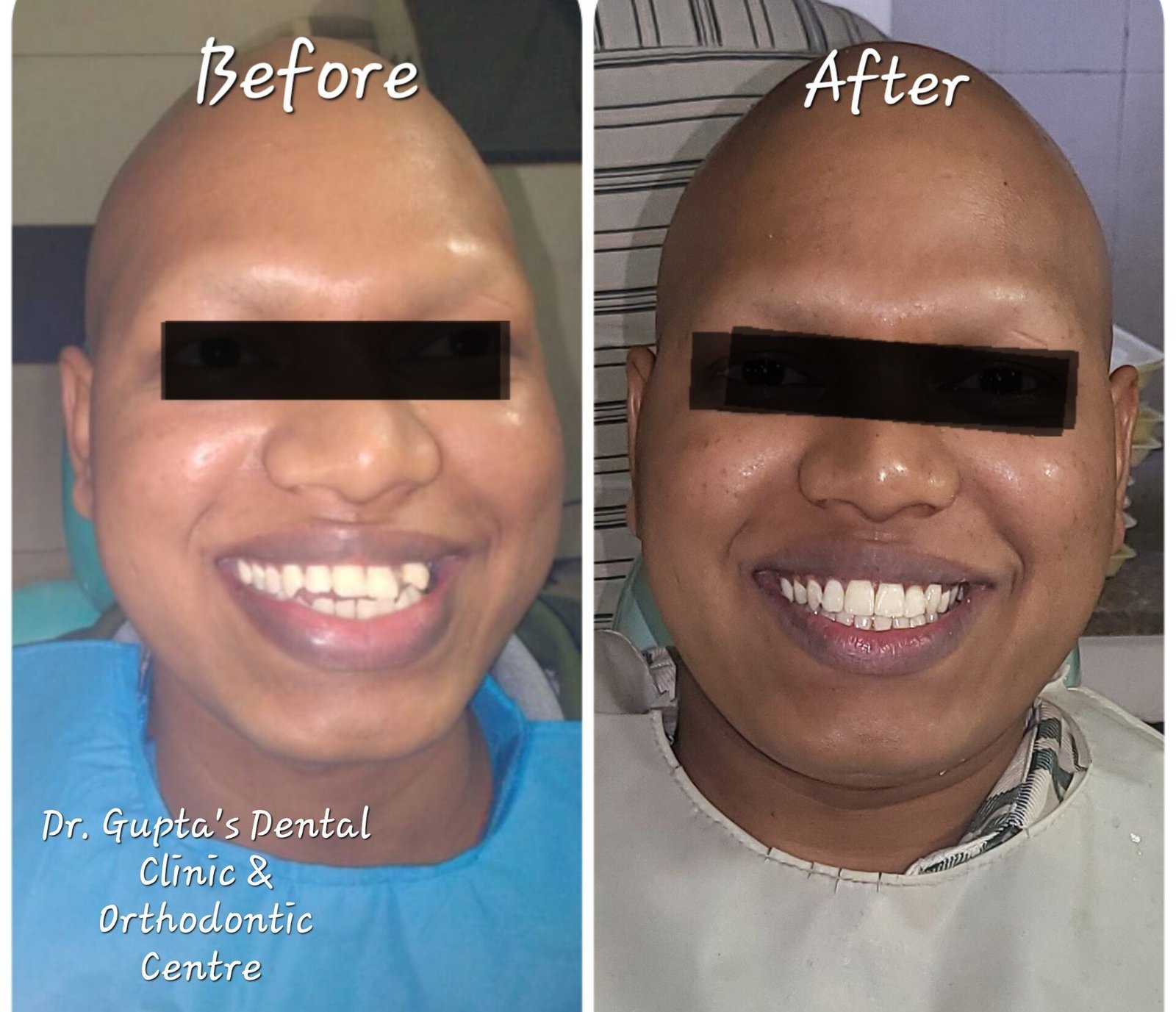 Improve your smile with trusted smile makeover services in Noida today